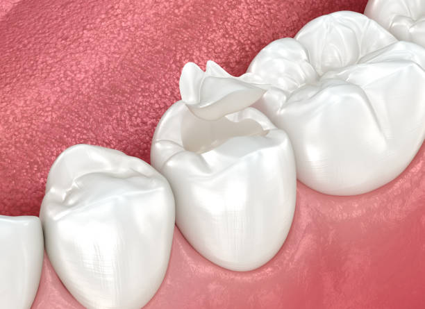 Best Dental Fillings (Composite and Amalgam)  in Greenville, KY